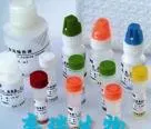 Phosphoglycerate isomerase / Pyruvate phosphate isomerase / Glyceraldehyde phosphate isomerase / 9023